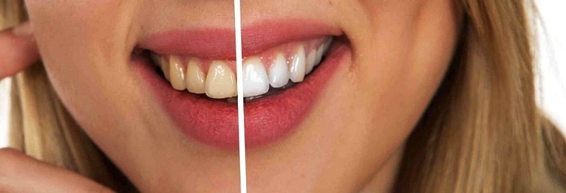 tooth-2414909-scaled-compressed (1)